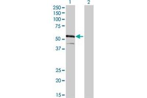 Western Blot analysis of IRF4 expression in transfected 293T cell line by IRF4 monoclonal antibody (M02), clone 2F2. (IRF4 antibody  (AA 342-451))