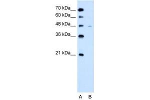 WB Suggested Anti-SLC43A3  Antibody Titration: 2. (SLC43A3 antibody  (N-Term))