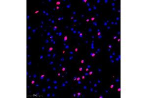Immunofluorescence of paraffin embedded mouse brain using kb12 (ABIN7075406) at dilution of 1:700 (300x lens) (p130 antibody)