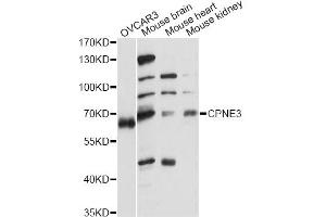 Western blot analysis of extracts of various cell lines, using CPNE3 antibody (ABIN6291660) at 1:1000 dilution.