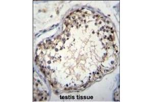 OVOS Antibody (N-term) (ABIN655570 and ABIN2845070)a immunohistochemistry analysis in formalin fixed and paraffin embedded human testis tissue followed by peroxidase conjugation of the secondary antibody and DAB staining. (OVOS1 (AA 99-128), (N-Term) antibody)