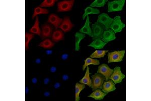 ABIN6258547 and ABIN6275031 staining Hela cells by IF/ICC.