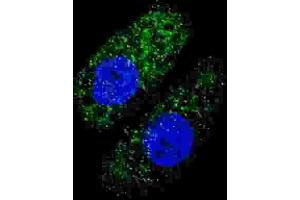 Immunofluorescence (IF) image for anti-ATG5 Autophagy Related 5 (ATG5) antibody (ABIN2999977) (ATG5 antibody)