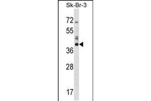 Western blot analysis in SK-BR-3 cell line lysates (35ug/lane). (HSD17B1 antibody  (C-Term))