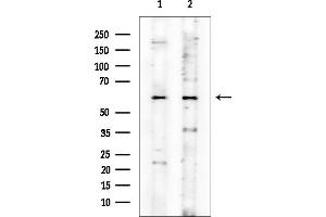 Western blot analysis of lysates from various samples, using PPP3CA Mouse Monoclonal Antibody at 1/1000 dilution.