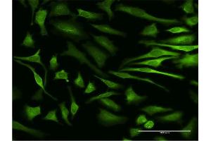 Immunofluorescence of monoclonal antibody to MAPKAPK5 on HeLa cell. (MAPKAP Kinase 5 antibody  (AA 371-471))
