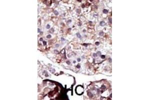 Immunohistochemistry (IHC) image for anti-Sphingosine Kinase 2 (SPHK2) antibody (ABIN3003068) (SPHK2 antibody)