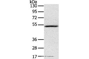 Western blot analysis of Human normal liver tissue, using IL17RB Polyclonal Antibody at dilution of 1:200 (IL17 Receptor B antibody)