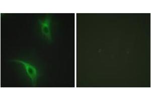 Immunofluorescence analysis of HeLa cells, using CKS1 Antibody. (CKS1 antibody  (AA 10-59))