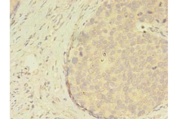 ATXN7L3 antibody  (AA 51-347)