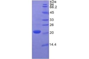 SDS-PAGE of Protein Standard from the Kit (Highly purified E. (Caspase 1 ELISA Kit)