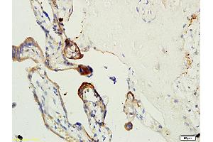 Formalin-fixed and paraffin embedded human placenta tissue labeled with Anti-Factor XIII Polyclonal Antibody, Unconjugated (ABIN731738) at 1:200 followed by conjugation to the secondary antibody, (SP-0023), and DAB staining (Factor XIII antibody  (AA 331-732))