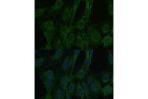 Immunofluorescence analysis of C6 cells using F antibody (ABIN6129530, ABIN6140428, ABIN6140430 and ABIN6215290) at dilution of 1:100. (FABP7 antibody  (AA 1-132))