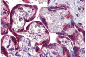 Human Placenta: Formalin-Fixed, Paraffin-Embedded (FFPE) (LTA4H antibody  (AA 467-516))