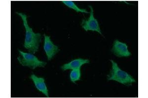 ICC/IF analysis of LYVE-1 in A549 cells line, stained with DAPI (Blue) for nucleus staining and monoclonal anti-human LYVE-1 antibody (1:100) with goat anti-mouse IgG-Alexa fluor 488 conjugate (Green). (LYVE1 antibody  (AA 25-235))