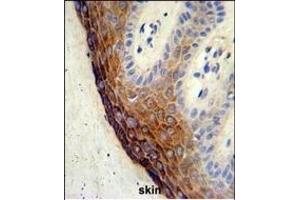 Formalin-fixed and paraffin-embedded human skin tissue reacted with ECE-1 Antibody (C-term), which was peroxidase-conjugated to the secondary antibody, followed by DAB staining. (ECE1 antibody  (AA 528-556))