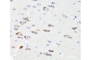 Immunohistochemistry of paraffin-embedded Rat brain using PIK3CA Polyclonal Antibody at dilution of 1:100 (40x lens). (PIK3CA antibody)