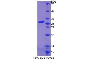 SDS-PAGE (SDS) image for rho Family GTPase 1 (RND1) (AA 1-229) protein (His tag) (ABIN6238861)