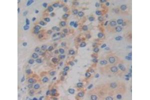 Used in DAB staining on fromalin fixed paraffin- embedded Kidney tissue (CCDC60 antibody  (AA 388-520))