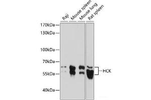 Western blot analysis of extracts of various cell lines using HCK Polyclonal Antibody at dilution of 1:1000. (HCK antibody)