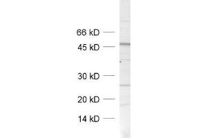 dilution: 1 : 1000, sample: crude synaptosomal fraction of rat brain (P2) (SNAP47 antibody)