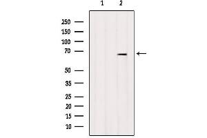 Western blot analysis of extracts from Mouse lung, using ARSJ Antibody. (ARSJ antibody  (Internal Region))