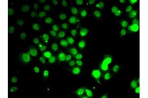 Immunofluorescence analysis of HeLa cells using GABARAP antibody (ABIN6134237, ABIN6140873, ABIN6140876 and ABIN6217999).
