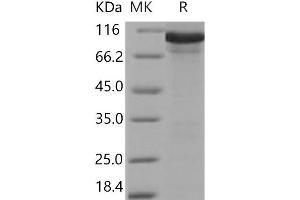 Western Blotting (WB) image for Alanyl tRNA Synthetase (AARS) protein (His tag) (ABIN7320298)
