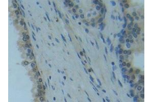 Detection of Raftlin in Human Prostate Tissue using Polyclonal Antibody to Raft Linking Protein (Raftlin) (RFTN1 antibody  (AA 288-520))