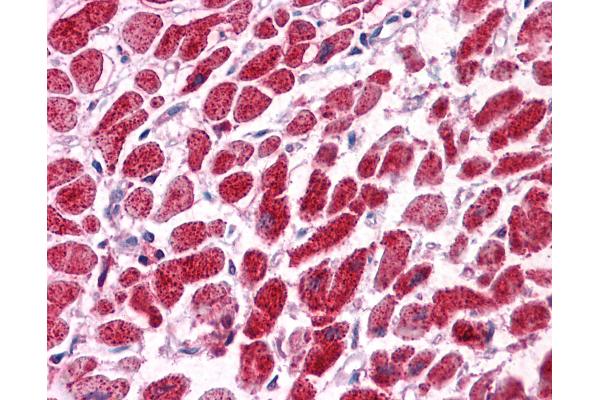 SNF8 antibody  (N-Term)