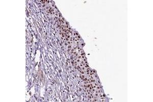 Immunohistochemical staining of human urinary bladder with SAMD10 polyclonal antibody  shows strong nuclear positivity in urothelial cells. (SAMD10 antibody)