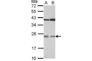 WB Image Sample (30 ug of whole cell lysate) A: 293T B: A431 12% SDS PAGE antibody diluted at 1:1000 (TMED7 antibody  (Center))