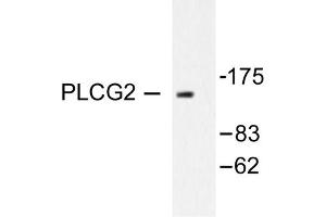 Image no. 1 for anti-Phospholipase C gamma 2 (PLCG2) antibody (ABIN271905) (Phospholipase C gamma 2 antibody)