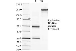 SDS-PAGE Analysis of Purified anti-Biotin Mouse Monoclonal antibody (Hyb-8). (Biotin antibody)