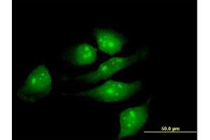 Immunofluorescence of purified MaxPab antibody to METTL2 on HeLa cell. (METTL2B antibody  (AA 1-313))