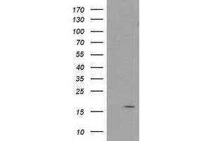 Image no. 1 for anti-Baculoviral IAP Repeat-Containing 5 (BIRC5) antibody (ABIN1501247) (Survivin antibody)