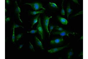 Immunofluorescence staining of U251 cells with ABIN7143857 at 1:66, counter-stained with DAPI. (CRYAB antibody  (AA 1-175))