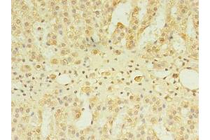 Immunohistochemistry of paraffin-embedded human adrenal gland tissue using ABIN7147640 at dilution of 1:100 (CSGALNACT2 antibody  (AA 33-270))