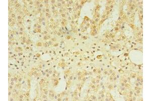 Immunohistochemistry of paraffin-embedded human adrenal gland tissue using ABIN7147640 at dilution of 1:100 (CSGALNACT2 antibody  (AA 33-270))