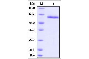 Rhesus macaque CD40, Fc Tag on SDS-PAGE under reducing (R) condition. (CD40 Protein (CD40) (AA 21-193) (Fc Tag))