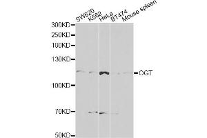Western blot analysis of extracts of various cell lines, using OGT antibody (ABIN5998410) at 1/1000 dilution. (OGT antibody)
