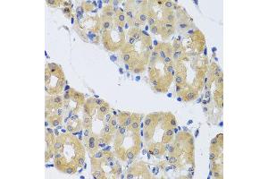 Immunohistochemistry of paraffin-embedded human gastric using DYNC1I1 antibody at dilution of 1:100 (x40 lens).