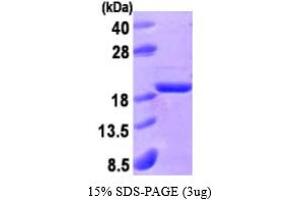 SDS-PAGE (SDS) image for Acid Phosphatase 1, Soluble (ACP1) (AA 1-158) protein (His tag) (ABIN666750)