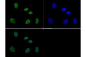 Immunofluorescence of Rabbit Anti-Histone H3 [p Thr11, p Ser10] Antibody.