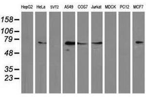 Image no. 2 for anti-Mahogunin, Ring Finger 1 (MGRN1) antibody (ABIN1499459) (Mahogunin RING Finger Protein 1 antibody)