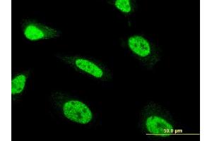 Immunofluorescence of monoclonal antibody to ZNF71 on HeLa cell. (ZNF71 antibody  (AA 1-100))