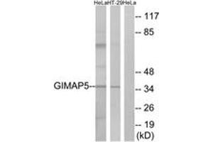 Western blot analysis of extracts from HeLa/HT-29 cells, using GIMAP5 Antibody. (GIMAP5 antibody  (AA 231-280))