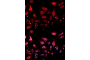 Immunofluorescence analysis of U2OS cells using RACGAP1 antibody (ABIN5973044). (RACGAP1 antibody)