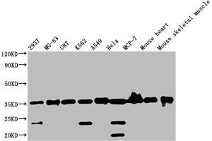 Western Blot Positive WB detected in: Mouse skeletal muscle tissue All lanes: ANKRD23 antibody at 2. (ANKRD23 antibody  (AA 1-200))