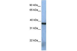 NAT12 antibody used at 1 ug/ml to detect target protein. (NAA30 antibody  (Middle Region))